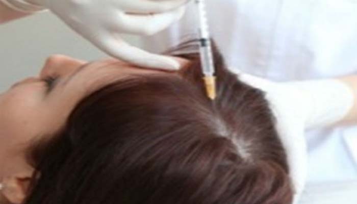 Mesotherapy Hair Loss Treatment